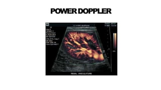 POWERDOPPLER
 