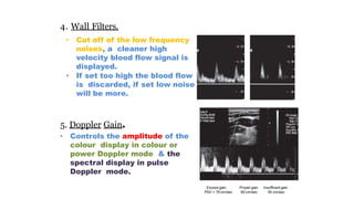 4. Wall Filters.
• Cut off of the low frequency
noises, a cleaner high
velocity blood flow signal is
displayed.
• If set too high the blood flow
is discarded, if set low noise
will be more.
5. Doppler Gain.
• Controls the amplitude of the
colour display in colour or
power Doppler mode & the
spectral display in pulse
Doppler mode.
Excess gain
PSV = 75 cm/sec
Proper gain
60 cm/sec
Insufficent gain
50 cm/sec
 