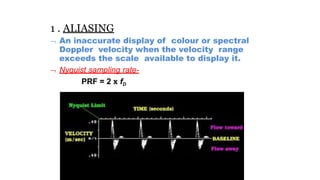 1 . ALIASING
 An inaccurate display of colour or spectral
Doppler velocity when the velocity range
exceeds the scale available to display it.
 Nyquist sampling rate-
PRF = 2 x fD
 