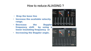 How to reduce ALIASING ?
• Drop the base line
• Increase the available velocity
range.
• Decrease the Doppler
frequency shift by using a
lower insolating frequency or
• Increasing the Doppler angle.
 