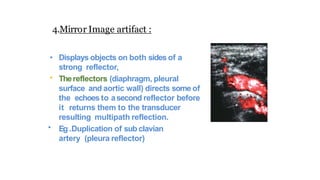 4.Mirror Image artifact :
•
•
• Displays objects on both sides of a
strong reflector,
Thereflectors (diaphragm, pleural
surface and aortic wall) directs some of
the echoes to asecond reflector before
it returns them to the transducer
resulting multipath reflection.
Eg .Duplication of sub clavian
artery (pleura reflector)
 