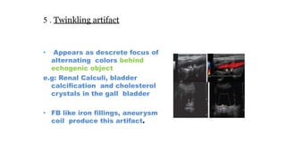 5 . Twinkling artifact
• Appears as descrete focus of
alternating colors behind
echogenic object
e.g: Renal Calculi, bladder
calcification and cholesterol
crystals in the gall bladder
• FB like iron fillings, aneurysm
coil produce this artifact.
 