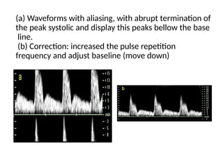 doppler physics medical imaging in human body in seminar content ppt.pptx