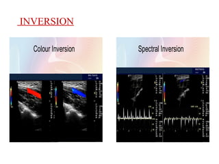 doppler physics medical imaging in human body in seminar content ppt.pptx