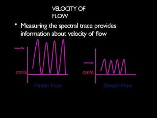 Faster Flow DOPPLER PHYSICS and interpretation of doppler waveform Presentation | PPTX