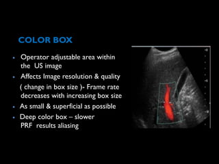 DOPPLER PHYSICS and interpretation of doppler waveform Presentation | PPTX