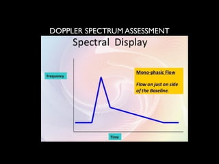 DOPPLER PHYSICS and interpretation of doppler waveform Presentation | PPTX