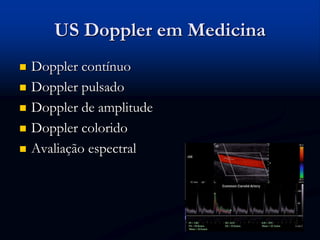 US Doppler em Medicina
 Doppler contínuo
 Doppler pulsado
 Doppler de amplitude
 Doppler colorido
 Avaliação espectral
 