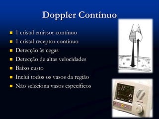 Doppler Contínuo
 1 cristal emissor contínuo
 1 cristal receptor contínuo
 Detecção às cegas
 Detecção de altas velocidades
 Baixo custo
 Inclui todos os vasos da região
 Não seleciona vasos específicos
 