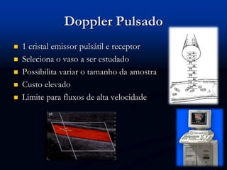 Doppler Pulsado
 1 cristal emissor pulsátil e receptor
 Seleciona o vaso a ser estudado
 Possibilita variar o tamanho da amostra
 Custo elevado
 Limite para fluxos de alta velocidade
 