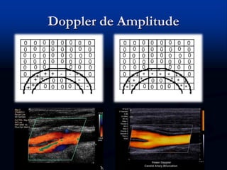 Doppler de Amplitude
 