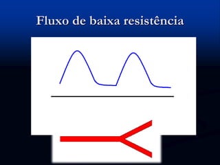 Fluxo de baixa resistência
 