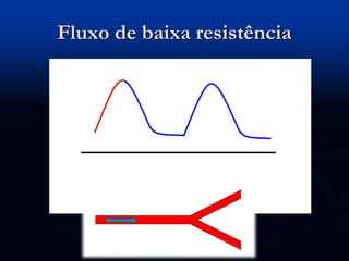 Fluxo de baixa resistência
 