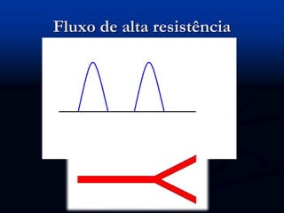 Fluxo de alta resistência
 