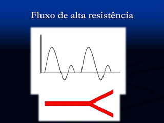 Fluxo de alta resistência
 