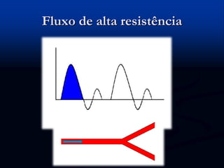 Fluxo de alta resistência
 