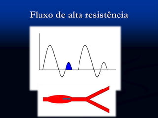 Fluxo de alta resistência
 