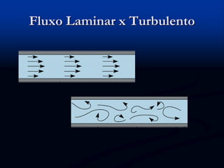 Fluxo Laminar x Turbulento
 