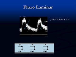 Fluxo Laminar
JANELA SISTÓLICA
 