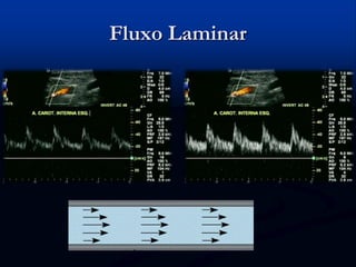 Fluxo Laminar
 