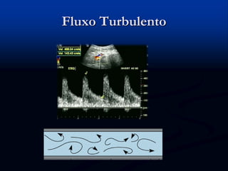 Fluxo Turbulento
 