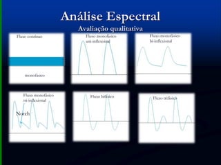Fluxo contínuo Fluxo monofásico
uni-inflexoinal
Fluxo monofásico
bi-inflexional
Fluxo monofásico
tri-inflexional
Fluxo bifásico Fluxo trifásico
Notch
Análise Espectral
Avaliação qualitativa
monofásico
 