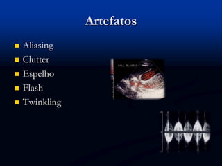 Artefatos
 Aliasing
 Clutter
 Espelho
 Flash
 Twinkling
 