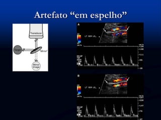 Artefato “em espelho”
 