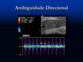 Ambiguidade Direcional
 