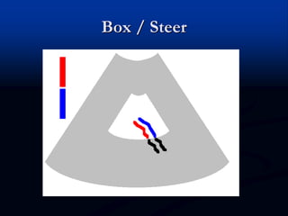 Box / Steer
 