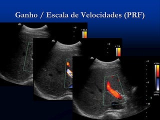 Ganho / Escala de Velocidades (PRF)
 