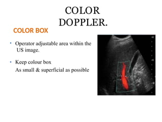 Doppler principle Evaluation of waveform .pptx
