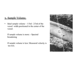 Middle Volume Sample Doppler principle Evaluation of waveform .pptx