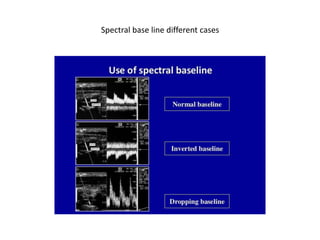 Spectral base line different cases
 