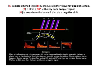 [A] is more alligned than [B] & produces higher-frquency doppler signals.
[C] is almost 90^ with very poor doppler signal.
[D] is away from the beam & there is a negative shift.
 