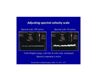 Doppler principles [1]