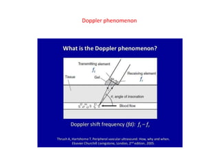 Doppler phenomenon
 