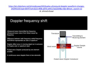 https://pt.slideshare.net/ahmedesawy543/duplex-ultrasound-doppler-waveform-changes-
242945335?qid=007f77a4-8223-4f08-a870-a44517ab2264&v=&b=&from_search=12
dr. ahmed elsawi
 