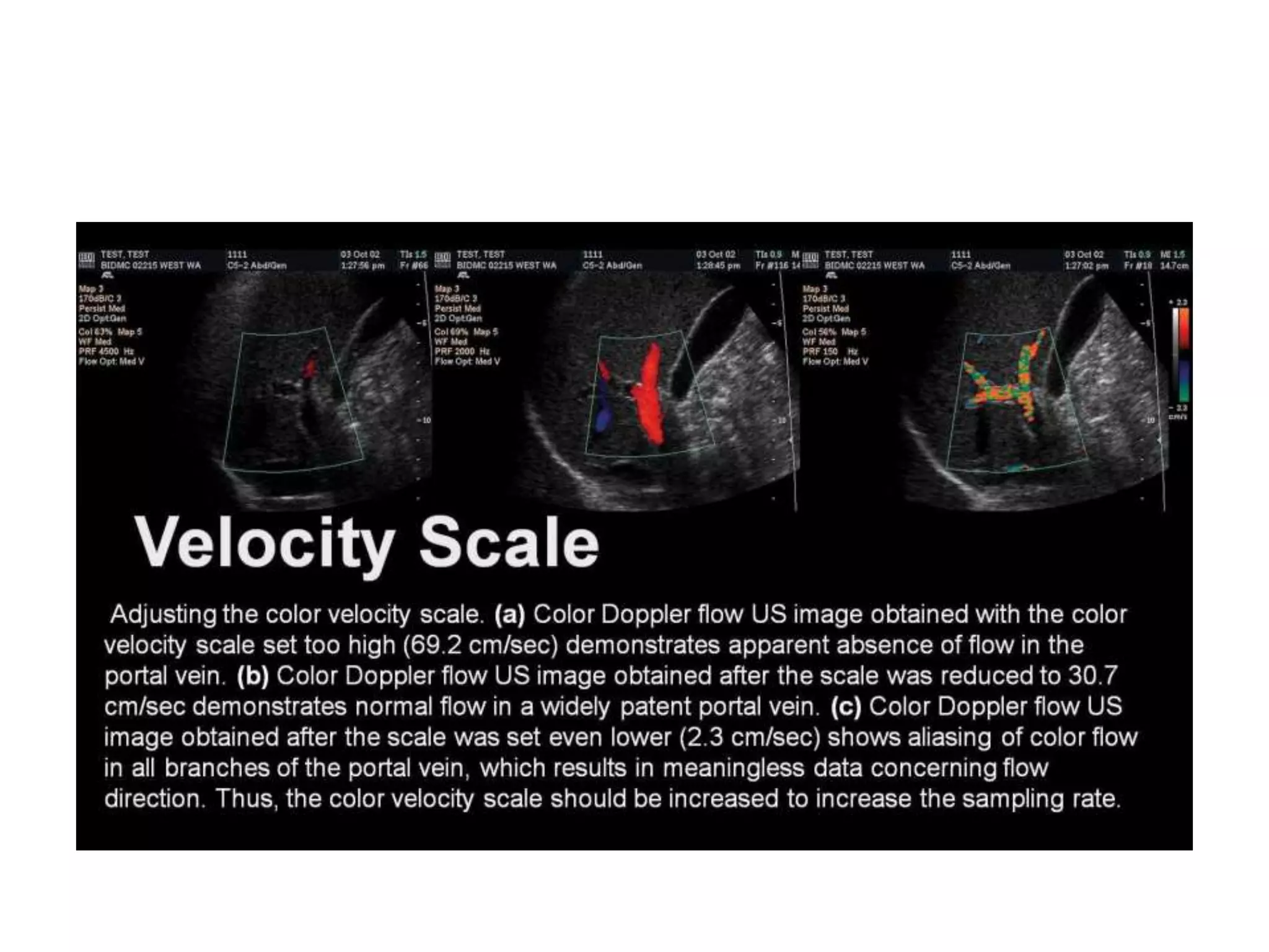Doppler principles [2]