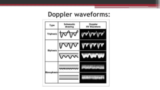 Doppler Sonography: Principles and Artifacts | PPTX