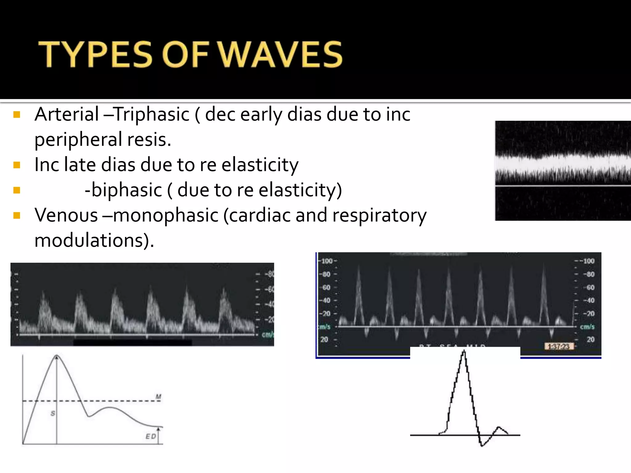Doppler study general bases | PPT