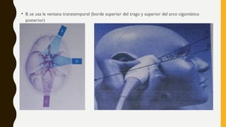 Doppler transcraneal en paciente critico.pptx