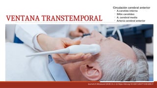 DOPPLER TRANSCRANEAL ARIDAIT OLVERA.pptx