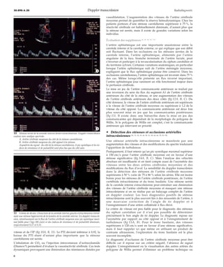 30-890-A-20 Doppler transcrânien Radiodiagnostic 
vitesse et de l’IP (fig 10A, B, 11). Le PTI devient inférieur à 0,92, la 
baisse du PTI étant d’autant plus importante que la sténose 
carotidienne est serrée. 
L’inhalation de CO2 ou l’injection intraveineuse d’acétazolamide 
(Diamoxt) permettent d’évaluer la vasoréactivité cérébrale. Ces tests 
dynamiques provoquent une diminution des résistances distales par 
vasodilatation. L’augmentation des vitesses de l’artère cérébrale 
moyenne permet de quantifier la réserve hémodynamique. Chez les 
patients porteurs d’une sténose carotidienne supérieure à 75 %, la 
réactivité cérébrale est habituellement diminuée, d’autant plus que 
la sténose est serrée, mais il existe de grandes variations selon les 
individus. 
Évaluation des suppléances [6, 25, 42, 63, 71] 
L’artère ophtalmique est une importante anastomose entre la 
carotide interne et la carotide externe, ce qui explique que son débit 
soit fluctuant. Dans les occlusions ou les sténoses serrées de la 
carotide interne, l’artère ophtalmique, alimentée par l’artère 
angulaire de la face, branche terminale de l’artère faciale, peut 
s’inverser et participer à la revascularisation du siphon carotidien et 
du territoire sylvien. Certaines variations anatomiques, en particulier 
lorsque l’artère ophtalmique naît de l’artère méningée moyenne, 
expliquent que le flux ophtalmique puisse être conservé. Dans les 
occlusions carotidiennes, l’artère ophtalmique est inversée dans 75 % 
des cas. Même lorsqu’elle présente un flux inversé important, 
l’artère ophtalmique joue rarement un rôle fonctionnel majeur dans 
la perfusion cérébrale. 
La mise en jeu de l’artère communicante antérieure se traduit par 
une inversion du sens du flux du segment A1 de l’artère cérébrale 
antérieure du côté de la sténose, et une augmentation des vitesses 
de l’artère cérébrale antérieure des deux côtés (fig 12A, B, C). Du 
côté donneur, la vitesse de l’artère cérébrale antérieure est supérieure 
à la vitesse de l’artère cérébrale moyenne ou supérieure à 1,2 de la 
vitesse du côté opposé. La communicante antérieure est deux fois 
plus souvent mise en jeu que les communicantes postérieures 
(fig 13). Il existe donc une hiérarchie dans la mise en jeu des 
communicantes qui dépendrait de la morphologie du polygone de 
Willis. Si le polygone de Willis est complet, c’est la communicante 
antérieure qui intervient en priorité. 
¦ Détection des sténoses et occlusions artérielles 
intracrâniennes [18, 23, 24, 39, 46, 50, 51, 58, 64, 66, 78, 92, 93] 
Une sténose artérielle intracrânienne se manifeste par une 
augmentation des vitesses et des modifications du spectre traduisant 
l’apparition de turbulences. 
Pratiquement, il faut retenir qu’un pic systolique maximal supérieur 
à 150 cm/s pour l’artère cérébrale moyenne est en faveur d’une 
sténose significative (fig 14A, B, C). Mais l’analyse des vélocités 
absolues est insuffisante et on tient compte aussi de l’asymétrie des 
vitesses entre les deux artères cérébrales moyennes et des 
modifications du flux d’aval. La sensibilité du doppler transcrânien 
dans la détection des sténoses de l’artère cérébrale moyenne 
supérieures à 50 % varie de 75 à 86 % selon les séries. Elle est moins 
bonne pour les sténoses de l’artère cérébrale postérieure, de l’artère 
vertébrale intracrânienne et du tronc basilaire. Une sténose serrée 
de la carotide interne extracrânienne peut entraîner une diminution 
des vitesses de l’artère cérébrale moyenne et masquer une sténose 
intracrânienne si on ne réalise pas un balayage complet de l’artère 
en doppler couleur. Les faux diagnostics positifs de sténose 
intracrânienne sont le plus souvent liés à des sinuosités de l’artère, à 
une mauvaise correction de l’angle de tir doppler et à 
l’enregistrement d’une artère collatérale à flux élevé. 
Le critère de vitesse est peu fiable pour le diagnostic des sténoses 
du siphon carotidien car il n’est pas possible de déterminer 
précisément le bon angle de tir doppler. Le diagnostic repose sur 
l’asymétrie par rapport au côté opposé et à l’enregistrement de 
turbulences (fig 15A, B). Pour le tronc basilaire, des vitesses 
supérieures à 120 cm/s sont en faveur d’une sténose significative, 
mais il faut rappeler ici que même en utilisant un produit de 
contraste ultrasonore, l’exploration du tronc basilaire est le plus 
souvent incomplète. 
Le diagnostic d’occlusion de l’artère cérébrale moyenne peut être 
difficile car il repose sur un critère négatif, l’absence de signal 
doppler. L’enregistrement ou la visualisation des autres artères du 
polygone de Willis permet d’éliminer un problème technique ou 
10 Sténose serrée de la carotide interne droite extracrânienne. Doppler transcrânien 
couleur avec analyse spectrale. 
A. Artère cérébrale moyenne du côté de la sténose carotidienne. 
B. Artère cérébrale moyenne du côté opposé à la sténose. 
Asymétrie du signal : du côté de la sténose carotidienne, le pic systolique et les in-dices 
de résistance et de pulsatilité sont plus bas que du côté sain. 
*A 
*B 
11 Femme de 40 ans. Dissection de la carotide interne gauche extracrânienne entraî-nant 
une sténose hyperserrée de la lumière de la carotide interne. En doppler transcrâ-nien, 
retentissement sur le flux de l’artère cérébrale moyenne avec pic systolique maxi-mal 
faible pour l’âge (80 cm/s) et des indices de résistance et de pulsatilité diminués, 
respectivement 0,27 et 0,31. 
6 
 