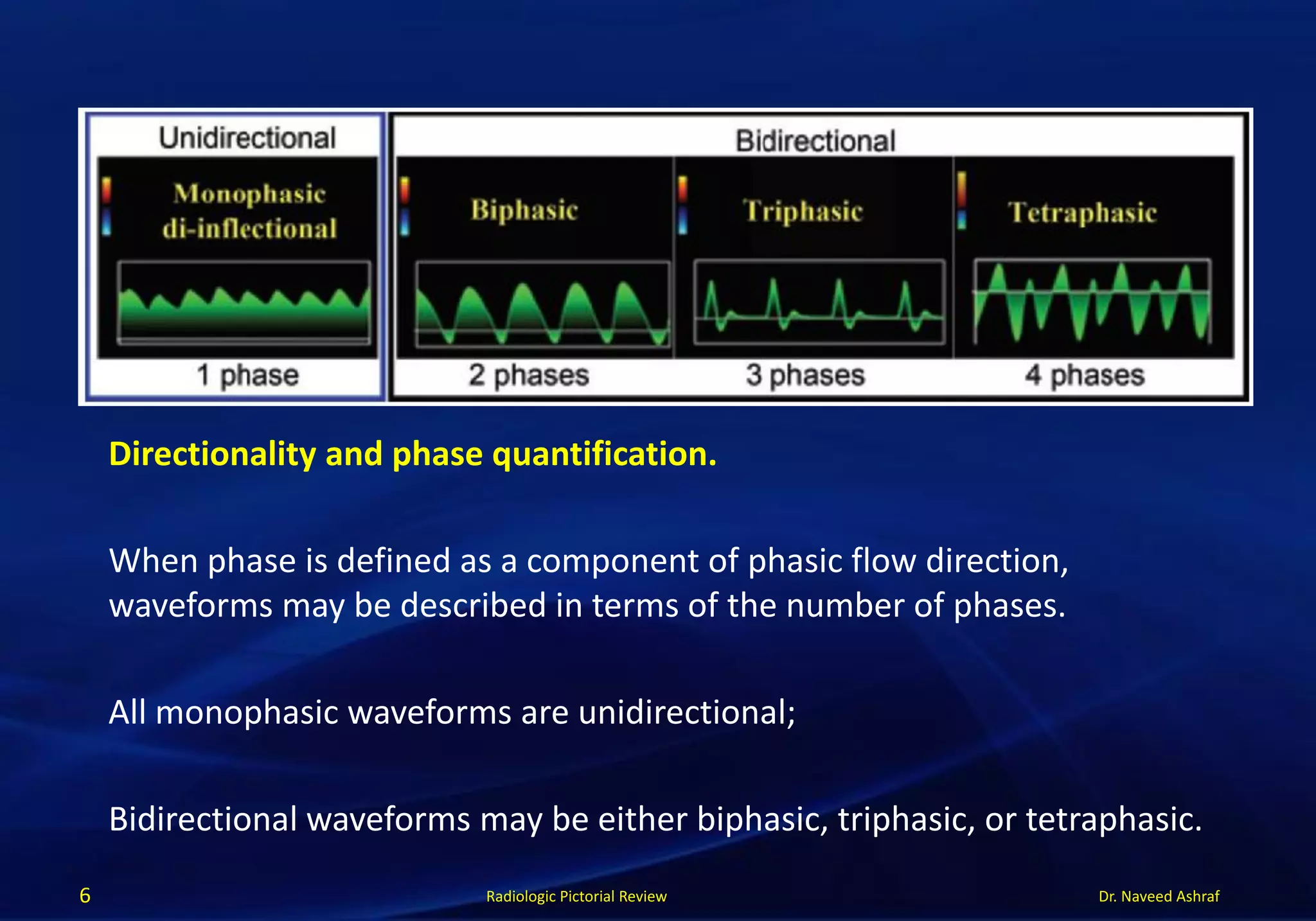 Dr. Naveed AshrafRadiologic Pictorial Review
Directionality and phase quantification.
When phase is defined as a component of phasic flow direction,
waveforms may be described in terms of the number of phases.
All monophasic waveforms are unidirectional;
Bidirectional waveforms may be either biphasic, triphasic, or tetraphasic.
6
 