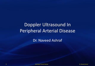 Dr. Naveed AshrafRadiologic Pictorial Review
Doppler Ultrasound In
Peripheral Arterial Disease
Dr. Naveed Ashraf
1
 
