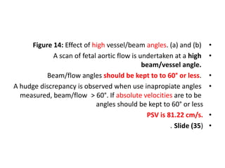 •
Figure 14: Effect of high vessel/beam angles. (a) and (b)
•
A scan of fetal aortic flow is undertaken at a high
beam/vessel angle.
•
Beam/flow angles should be kept to to 60° or less.
•
A hudge discrepancy is observed when use inapropiate angles
> 60°. If absolute velocities are to be
measured, beam/flow
angles should be kept to 60° or less
•
PSV is 81.22 cm/s.
•
Slide (35)
.
 