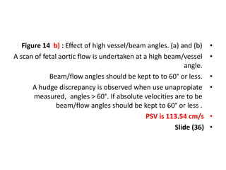 •
Figure 14 b) : Effect of high vessel/beam angles. (a) and (b)
•
A scan of fetal aortic flow is undertaken at a high beam/vessel
angle.
•
Beam/flow angles should be kept to to 60° or less.
•
A hudge discrepancy is observed when use unapropiate
angles > 60°. If absolute velocities are to be
measured,
beam/flow angles should be kept to 60° or less .
•
PSV is 113.54 cm/s
•
Slide (36)
 