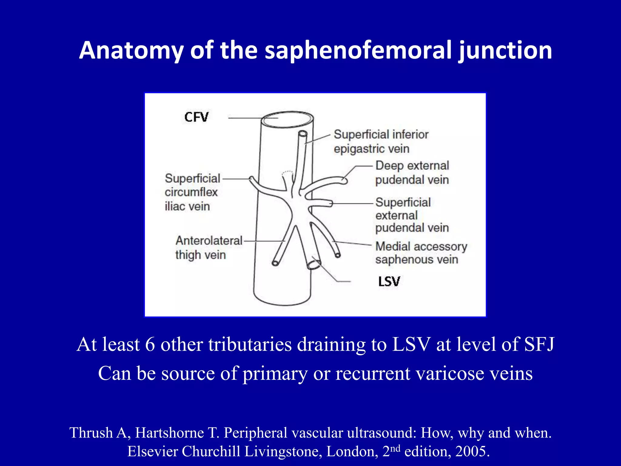 doppler-ultrasound-in-deep-vein-thrombosis-pptx