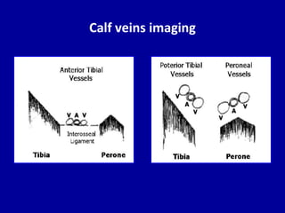 Doppler ultrasound in deep vein thrombosis | PPTX